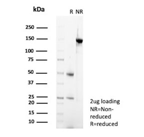 SDS-PAGE analysis of purified, BSA-free Biotin antibody (clone BTN/36) as confirmation of integrity and purity.