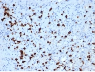 IHC analysis of Myeloperoxidase/MPO antibody in human bone marrow tissue. Formalin-fixed, paraffin-embedded human bone marrow shows HRP-DAB brown granular cytoplasmic staining in myeloid lineage cells using Myeloperoxidase/MPO antibody (clone MPO/7118). Hematoxylin counterstain highlights nuclei in blue. Heat induced epitope retrieval was performed by boiling tissue sections in pH 9 10mM Tris with 1mM EDTA for 20 minutes followed by cooling prior to staining.
