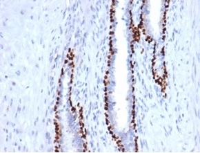 deltaNp63 Antibody. Immunohistochemistry analysis of FFPE human prostate tissue demonstrates strong HRP-DAB brown nuclear staining in basal epithelial cells outlining glandular structures, while luminal secretory cells remain negative. The nuclear-restricted pattern highlights epithelial cell populations and supports use of this antibody as an epithelial identity regulator, with deltaNp63 expression reflecting TP63-driven maintenance of epithelial lineage. Staining is crisp with minimal background, allowing clear visualization of gland architecture and basal cell compartmentalization. Heat-induced epitope retrieval was performed by boiling tissue sections in pH 9 10mM Tris with 1mM EDTA for 20 minutes followed by cooling prior to antibody incubation.