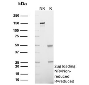 SDS-PAGE analysis of purified, BSA-free recombinant CD47 antibody (clone rCD47/6589) as confirmation of integrity and purity.