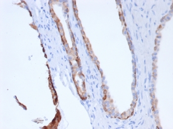 Pan CK Antibody human prostate IHC. Immunohistochemistry analysis of cytokeratin expression in FFPE human prostate tissue using Pan CK antibody clone rPCK/6750. Cytoplasmic HRP-DAB brown staining highlights epithelial cells lining glandular structures, clearly distinguishing epithelial compartments from surrounding stromal tissue. The staining pattern supports rapid identification of epithelial cells and visualization of glandular architecture. HIER was performed by boiling tissue sections in pH 9 10 mM Tris with 1 mM EDTA for 20 minutes followed by cooling prior to antibody incubation.