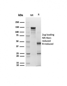 SDS-PAGE analysis of purified, BSA-free Pan CK Antibody / Epithelial Marker Antibody (Cocktail rPCK/6750) as confirmation of integrity and purity.