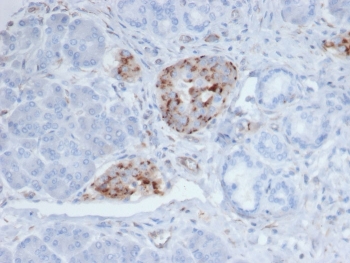 Chromogranin A Antibody Protein Microarray Validated Pancreas IHC. Immunohistochemistry staining of formalin-fixed, paraffin-embedded human pancreatic tissue with Chromogranin A antibody (clone CHGA/4219) shows cytoplasmic granular staining within islets of Langerhans, consistent with CHGA expression in pancreatic neuroendocrine cells, while surrounding exocrine acinar structures are largely negative. Heat-induced epitope retrieval was performed by boiling sections in pH 9 10mM Tris with 1mM EDTA for 20 minutes followed by cooling prior to testing.