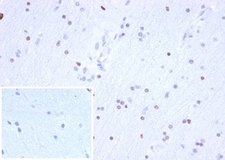 OLIG2 Antibody Brain IHC. Immunohistochemical analysis of Oligodendrocyte transcription factor 2 (OLIG2) in formalin-fixed, paraffin-embedded human brain tissue using OLIG2 antibody clone OLIG2/6695R. Scattered nuclear staining is observed in glial cells within the brain parenchyma, consistent with OLIG2 expression in oligodendrocyte lineage cells. The distribution of positive nuclei reflects normal neural tissue architecture. The antibody was applied at 2 ug/ml in PBS for 30 min at room temperature. Inset: PBS used in place of primary antibody serves as a negative control for secondary antibody binding. Required HIER: boil tissue sections in pH 9 10mM Tris with 1mM EDTA for 20 min and allow to cool before testing.