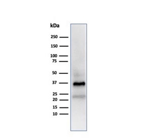 APO-J Antibody Testis WB. Western blot analysis of human testis lysate using APO-J antibody. The mouse monoclonal antibody clone CLU/4723 detects bands at approximately 75-80 kDa and lower molecular weight bands around 34-39 kDa, consistent with the predicted molecular weight of full-length Clusterin / APO-J and its processed alpha and beta subunits. This banding pattern reflects proteolytic cleavage and glycosylation of this secreted chaperone protein, supporting its role in lipid transport and extracellular protein stabilization in western blot analysis.