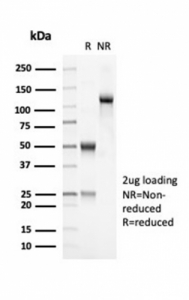 SDS-PAGE analysis of purified, BSA-free recombinant OLIG2 antibody (clone OLIG2/7074R) as confirmation of integrity and purity.