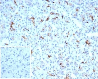 CFTR Antibody for IHC Pancreas. Immunohistochemistry analysis of Cystic fibrosis transmembrane conductance regulator / CFTR expression in FFPE human pancreatic tissue using recombinant rabbit monoclonal antibody clone CFTR/7003R. This CFTR antibody shows apical membranous HRP-DAB brown staining in pancreatic ductal epithelial cells, with minimal signal in surrounding acinar and stromal compartments; nuclei are counterstained blue. The staining pattern reflects polarized epithelial localization consistent with pancreatic duct structures. Inset shows a PBS-only negative control processed without primary antibody, confirming minimal non-specific background staining. Antigen retrieval was performed by boiling sections in 10 mM Tris buffer with 1 mM EDTA, pH 9, for 20 min followed by cooling at room temperature.
