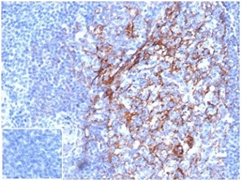 CD23 Antibody Germinal Center IHC. Immunohistochemistry of CD23 Antibody in human tonsil. FFPE human tonsil tissue was stained with CD23 antibody (clone FCER2/6887) at 2 ug/ml in PBS for 30 minutes at room temperature. Prominent membranous HRP-DAB brown staining is observed in B lymphocytes within germinal centers and mantle zone regions, consistent with known CD23 expression on mature follicular B cells. The staining pattern highlights follicular architecture, with dense membrane labeling in B cell rich areas and minimal staining in adjacent T cell predominant interfollicular zones. The negative control inset shows tissue processed with PBS in place of primary antibody, demonstrating absence of non-specific secondary antibody binding. Heat induced epitope retrieval was performed by boiling tissue sections in pH 9 Tris-EDTA buffer for 20 minutes followed by cooling prior to antibody incubation. Clone FCER2/6887 is supported by human protein microarray validation demonstrating target specificity.