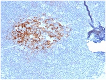 CD23 Antibody Human Lymph Node IHC. Immunohistochemistry of CD23 Antibody in human lymph node. FFPE human lymph node tissue was stained with CD23 antibody (clone FCER2/6887) at 2 ug/ml in PBS for 30 minutes at room temperature. Distinct membranous HRP-DAB brown staining is observed in B lymphocytes within follicular germinal centers, consistent with established CD23 expression on mature follicular B cells. The staining pattern highlights nodal follicular architecture, with strong membrane labeling in B cell rich regions and minimal staining in surrounding paracortical T cell areas. Heat induced epitope retrieval was performed by boiling tissue sections in pH 9 Tris-EDTA buffer for 20 minutes followed by cooling prior to antibody incubation. Clone FCER2/6887 is supported by human tissue protein microarray validation demonstrating target specificity.