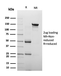 Chromogranin A Antibody Mouse Monoclonal SDS-PAGE. SDS-PAGE analysis of purified, BSA-free Chromogranin A antibody mouse monoclonal (clone CHGA/4223) as confirmation of integrity and purity.
