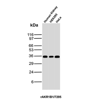 AKR1B1 Antibody Tissue and Cell Line WB. Western blot analysis of human kidney tissue together with HEK293 and HeLa cell lysates using AKR1B1 Antibody clone rAKR1B1/7295. Strong bands are detected near approximately 35-40 kDa across all samples, consistent with the predicted molecular weight of Aldose reductase / AKR1B1, an oxidative stress-associated aldo-keto reductase family enzyme involved in reactive aldehyde detoxification, glucose-responsive signaling, and cellular redox regulatory pathways.