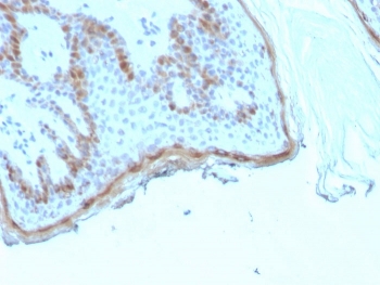Filaggrin Antibody Keratinocyte Differentiation IHC. Immunohistochemistry staining of FFPE human skin tissue with recombinant FLG antibody (clone rFLG/1945). HIER: boil tissue sections in pH 9 10mM Tris with 1mM EDTA for 20 min and allow to cool before testing.