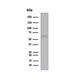 ESR1 Antibody MCF7 Cell WB. Western blot testing of human MCF-7 cell lysate using recombinant ESR1 antibody (clone ESR1/6983R).