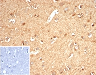Recombinant Aldose reductase Antibody Brain IHC. Immunohistochemistry staining of FFPE human brain tissue with recombinant Aldose reductase antibody (clone AKR1B1/7010R) at 2ug/ml in PBS for 30 min RT. Negative control inset: PBS used instead of primary antibody to control for secondary Ab binding. HIER: boil tissue sections in pH 9 10mM Tris with 1mM EDTA for 20 min and allow to cool before testing.