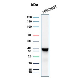 Recombinant Aldose reductase Antibody 293T Cell WB. Western blot testing of human 293T cell lysate with recombinant Aldose reductase antibody (clone AKR1B1/7010R). Predicted molecular weight ~36 kDa.