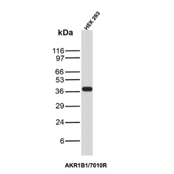 Recombinant Aldose Reductase Antibody HEK293T WB. Western blot analysis of HEK293T cell lysate using recombinant Aldose reductase Antibody clone AKR1B1/7010R. A strong band is detected near approximately 35-40 kDa, consistent with the predicted molecular weight of Aldose reductase / AKR1B1, an aldo-keto reductase family enzyme involved in polyol pathway metabolism, oxidative stress regulation, and glucose-responsive cellular signaling pathways.