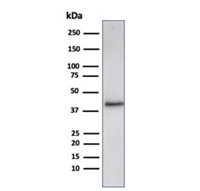 Recombinant Filaggrin Antibody A431 WB. Western blot analysis of human A431 cell lysate using recombinant Filaggrin antibody (clone FLG/3909R). Expected molecular weight: ~434 kDa (precursor); 37-45 kDa (processed).