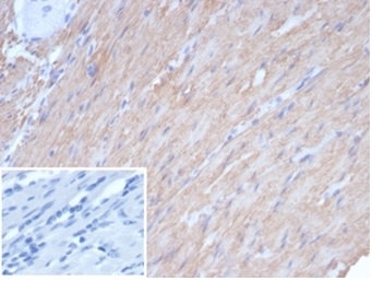CALD1 Antibody / Caldesmon Gene Expression Regulatory Protein Antibody. Immunohistochemistry analysis of Caldesmon (CALD1) in human smooth muscle tissue. FFPE human smooth muscle stained with CALD1 Antibody, clone rCALD1/7266, demonstrates strong HRP-DAB brown cytoplasmic staining in elongated smooth muscle cells arranged in parallel bundles. The uniform staining pattern is consistent with transcriptionally regulated CALD1 expression in differentiated cell populations. Inset: negative control using PBS in place of the primary antibody shows absence of brown signal, confirming specificity of staining. Heat-induced epitope retrieval was performed using Tris-EDTA buffer at pH 9.