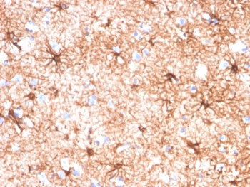 Glial Fibrillary Acidic Protein Antibody Human Cerebellum Tissue IHC. Immunohistochemistry staining of FFPE human cerebellum tissue with Glial Fibrillary Acidic Protein antibody (clone GFAP/4450). HIER: boil tissue sections in pH 9 10mM Tris with 1mM EDTA for 20 min and allow to cool before testing.