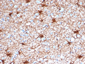 Glial Fibrillary Acidic Protein Antibody Cerebellum Immunohistochemistry. IHC staining of FFPE human cerebellum tissue with Glial Fibrillary Acidic Protein antibody (clone GFAP/4450). HIER: boil tissue sections in pH 9 10mM Tris with 1mM EDTA for 20 min and allow to cool before testing.