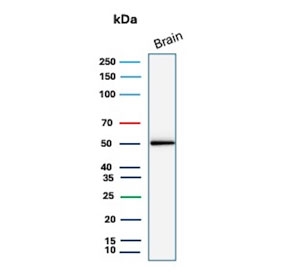 Glial Fibrillary Acidic Protein Antibody Brain WB. Western blot testing of human brain tissue lysate with Glial Fibrillary Acidic Protein antibody. Predicted molecular weight ~50 kDa.