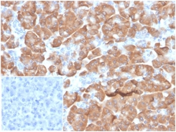 IHC staining of FFPE human pancreatic tissue with 40S Ribosomal protein SA (clone RPSA/6332R). Negative control inset: PBS instead of primary antibody to control for secondary binding. HIER: boil tissue sections in pH 9 10mM Tris with 1mM EDTA for 20 min and allow to cool before testing.