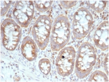 IHC staining of FFPE human colon tissue with 40S Ribosomal protein SA (clone RPSA/6332R). HIER: boil tissue sections in pH 9 10mM Tris with 1mM EDTA for 20 min and allow to cool before testing.