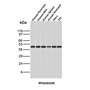 40S Ribosomal protein SA Antibody RPSA/6332R in Human Sample WB. Western Blot Analysis of Human Pancreas, Human Skin, Human Spleen, Human Stomach, HeLa and 3T3 lysates using Laminin Receptor 1 Recombinant Antibody (clone RPSA/6332R).