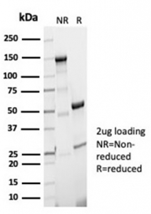 SDS-PAGE analysis of purified, BSA-free recombinant Aciculin antibody (clone PGM5/7005R) as confirmation of integrity and purity.