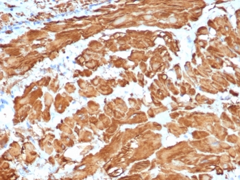 IHC staining of FFPE human uterus tissue with Actin (clone ACTA2/1614R). HIER: boil tissue sections in pH 9 10mM Tris with 1mM EDTA for 20 min and allow to cool before testing.
