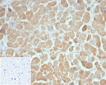 IHC staining of FFPE human heart tissue with recombinant recombinant ACTN2 antibody (clone ACTN2/7039R). Negative control inset: PBS instead of primary antibody to control for secondary binding. HIER: boil tissue sections in pH 9 10mM Tris with 1mM EDTA for 20 min and allow to cool before testing.