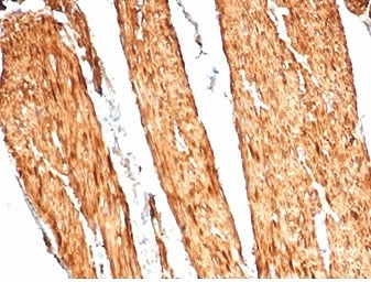 CAD Antibody / Caldesmon CALD1 Actin Cytoskeleton Organization Antibody. Immunohistochemistry analysis of Caldesmon (CALD1) in human colon tissue. FFPE human colon stained with CAD Antibody, clone CALD1/7024R, demonstrates strong HRP-DAB brown cytoplasmic staining in smooth muscle cells of the muscularis layer. The staining highlights elongated, spindle-shaped cells with dense filamentous cytoplasmic signal consistent with organized actin cytoskeleton structures and contractile filament bundles. Surrounding epithelial and stromal compartments show minimal staining, supporting localization of CALD1 to cytoskeletal networks within smooth muscle cells. Heat-induced epitope retrieval was performed using Tris-EDTA buffer at pH 9.