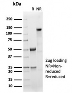 SDS-PAGE analysis of purified, BSA-free recombinant Sarcomeric Alpha Actinin antibody (clone ACTN2/7041R) as confirmation of integrity and purity.