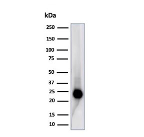 CD3 Epsilon Antibody for WB. Western blot analysis of CD3 Epsilon / CD3E antibody in human Jurkat cell lysate using CD3 Epsilon Antibody for WB / CD3e Western Blot Antibody (clone C3e/4653R). Lane 1: human Jurkat cell lysate. A band is detected at approximately 23 kDa, consistent with the predicted molecular weight of CD3 epsilon. The strong, well-defined band with minimal background demonstrates high signal clarity and supports reliable detection of CD3E in western blot analysis.
