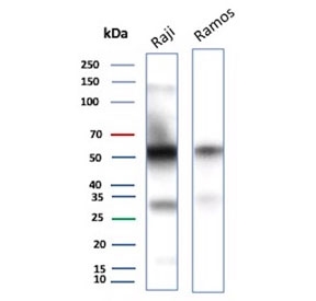 CD27 Antibody for WB. Western blot analysis of CD27 / TNFRSF7 expression in human B-cell lymphoma cell lines using CD27 Antibody. Lane 1: Raji cell lysate, Lane 2: Ramos cell lysate. A band is detected at approximately 50â60 kDa, consistent with glycosylated CD27, noting a lower predicted molecular weight of approximately 29 kDa for the core protein. Additional lower molecular weight signal may reflect unmodified or partially processed forms of CD27. The presence of CD27 signal in both Raji and Ramos cells aligns with known expression in B-cell lineage populations.