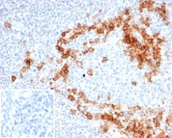 CD38 Antibody human tonsil tissue IHC. Immunohistochemistry analysis of CD38 expression in FFPE human tonsil tissue using CD38 antibody clone CD38/7017R. Strong membranous and cytoplasmic HRP-DAB brown staining highlights plasma cells and activated lymphocytes within interfollicular regions and surrounding germinal centers, consistent with a hematologic malignancy marker pattern for identifying lymphoid cell populations. The staining demonstrates dense immune cell distribution with clear contrast against predominantly negative background lymphocytes. Negative control inset: PBS was used in place of the primary antibody to control for secondary antibody binding. HIER was performed by boiling tissue sections in pH 9 10 mM Tris with 1 mM EDTA for 20 minutes followed by cooling prior to antibody incubation.