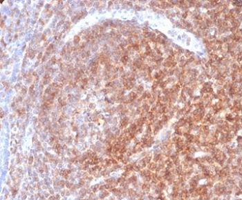 IHC staining of FFPE human lymph node with CD48 antibody (clone CD48/4787). HIER: boil tissue sections in pH 9 10mM Tris with 1mM EDTA for 20 min and allow to cool before testing.