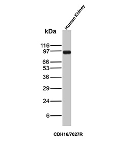Western blot testing of human kidney tissue lysate with recombinant Cadherin 16 antibody. Expected molecular weight: 90~130 kDa.
