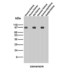 Cadherin 16 Antibody Multi-Species Kidney WB. Western blot analysis of Cadherin-16 / CDH16 expression across kidney tissue lysates from multiple species using Cadherin 16 antibody clone CDH16/7027R. Lane 1: human kidney lysate, Lane 2: mouse kidney lysate, Lane 3: rat kidney lysate, Lane 4: hamster kidney lysate, Lane 5: guinea pig kidney lysate, Lane 6: rabbit kidney lysate. Bands are detected at approximately 95-110 kDa in human, rat, and hamster kidney lysates, consistent with the predicted molecular weight of Cadherin-16 (CDH16), with the slightly higher apparent migration reflecting glycosylation of this kidney-restricted adhesion protein. Reduced or minimal signal is observed in mouse, guinea pig, and rabbit samples under these conditions, indicating species-dependent detection while maintaining strong reactivity in selected mammalian kidney tissues.
