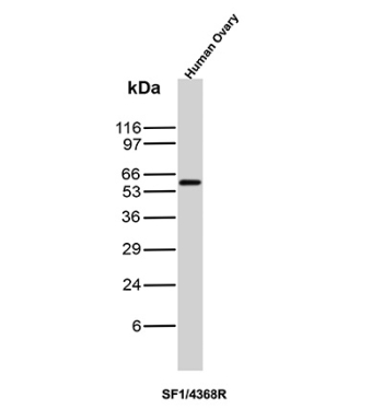 SF-1 Antibody for WB Ovary. Western blot analysis of human ovary tissue lysate using SF-1 Antibody detects a strong band at approximately 55-60 kDa, consistent with steroidogenic factor 1 / NR5A1. The observed signal aligns with the established role of SF-1 as a nuclear receptor transcription factor involved in ovarian steroidogenesis, endocrine differentiation, and reproductive tissue-associated transcriptional regulation pathways.