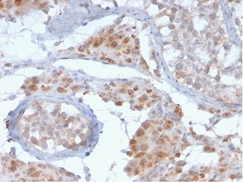 GCSAM Antibody Testis IHC. Immunohistochemistry analysis of FFPE human testis tissue stained with GCSAM Antibody demonstrates cytoplasmic and focal nuclear HRP-DAB brown staining within scattered immune-associated and germinal center-related cellular populations. This germinal center signaling antibody highlights GCSAM / HGAL-associated lymphoid differentiation pathways and germinal center-associated immune signaling biology. HIER: boil tissue sections in pH 9 10mM Tris with 1mM EDTA for 20 min and allow to cool before testing.