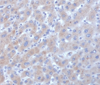 Alpha-1-Antichymotrypsin Antibody Human Liver Tissue IHC. Immunohistochemistry staining of FFPE human liver tissue with Alpha-1-Antichymotrypsin antibody (clone SERPINA3/4185). HIER: boil tissue sections in pH 9 10mM Tris with 1mM EDTA for 20 min and allow to cool before testing.