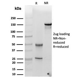 SDS-PAGE analysis of purified, BSA-free Alpha-1-Antichymotrypsin antibody (clone SERPINA3/4185) as confirmation of integrity and purity.