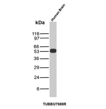 Beta Tubulin Antibody Human Brain Tissue WB. Western blot analysis of Beta III tubulin (TUBB3) expression in human brain tissue lysate using Beta Tubulin antibody clone TUBB3/7089R. Lane 1: human brain lysate. A band is detected at approximately 50â55 kDa, consistent with the predicted molecular weight of TUBB3, supporting reliable detection in neural samples.