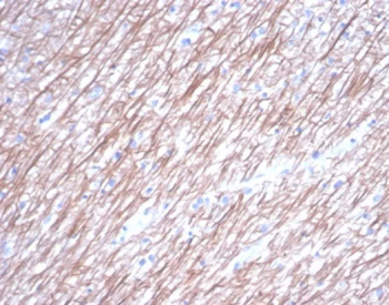 Beta Tubulin Antibody Brain IHC. Immunohistochemical analysis of Beta III tubulin (TUBB3) in formalin-fixed, paraffin-embedded human brain tissue using Beta Tubulin antibody clone TUBB3/7089R. Strong cytoplasmic staining is observed in neurons and neuropil, consistent with the localization of TUBB3 within neuronal microtubules. The staining pattern highlights neuronal processes and supports its use as a neural marker.