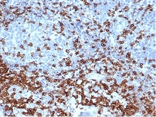 CD3e Antibody. Immunohistochemistry analysis of CD3 Epsilon / CD3E antibody in FFPE human tonsil tissue using CD3e Antibody / T Cell Receptor Signaling Marker Antibody with Clone C3e/4652R. Strong HRP-DAB brown membranous and cytoplasmic staining is observed in T lymphocytes within interfollicular and paracortical regions, consistent with T-cell zone distribution, while surrounding non-lymphoid cells show minimal background. The staining highlights CD3 epsilon as a key component of T cell receptor signaling within lymphoid tissue architecture. Heat-induced epitope retrieval was performed by boiling tissue sections in pH 9 10 mM Tris with 1 mM EDTA for 20 minutes followed by cooling prior to antibody incubation.
