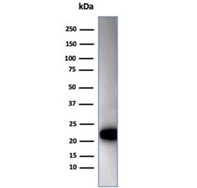 Western blot testing of human Jurkat cell lysate using recombinant CD3e antibody (clone C3e/4652R). Predicted molecular weight ~23 kDa.