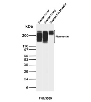 Fibronectin 1 Antibody Human Tissue WB. Western blot analysis was performed using Fibronectin 1 Antibody (clone FN1/3569). Lane 1: human liver tissue lysate; lane 2: human lung tissue lysate; lane 3: human skeletal muscle tissue lysate. A strong immunoreactive band is detected at approximately 220-250 kDa in all three tissue lysates, consistent with the expected molecular weight of fibronectin. These results demonstrate that this Extracellular Matrix Marker is suitable for Western blot detection of Fibronectin 1 across multiple human tissues.