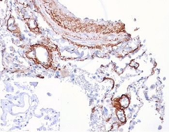 FGF21 Antibody Human Lung IHC. Immunohistochemistry analysis of FFPE human lung tissue stained with FGF21 Antibody / Metabolic Signaling Hormone Antibody clone FGF21/4343 demonstrates distinct cytoplasmic and membranous HRP-DAB brown staining within epithelial cell populations lining bronchial and alveolar-associated structures, consistent with the role of Fibroblast growth factor 21 / FGF21 in metabolic adaptation, endocrine signaling, and tissue-associated energy homeostasis pathways. The negative control inset using PBS in place of primary antibody demonstrates minimal background secondary antibody binding. HIER: boil tissue sections in pH 9 10mM Tris with 1mM EDTA for 20 min and allow to cool before testing.