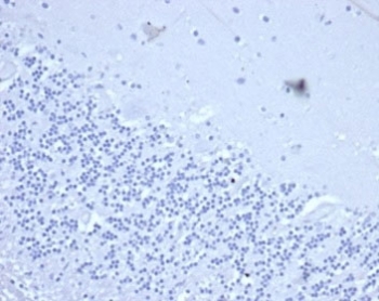 Negative control: IHC staining of FFPE human brain tissue with recombinant CD2 antibody (clone LFA2/3417R) at 2ug/ml in PBS for 30min RT. HIER: boil tissue sections in pH 9 10mM Tris with 1mM EDTA for 20 min and allow to cool before testing.